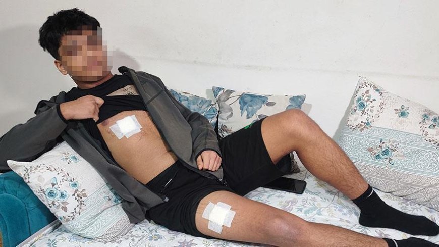 Mesajlaştığı kızın eski sevgilisi ve arkadaşları dehşeti yaşattı! ‘Bıçağı yedi, daha konuşamaz'