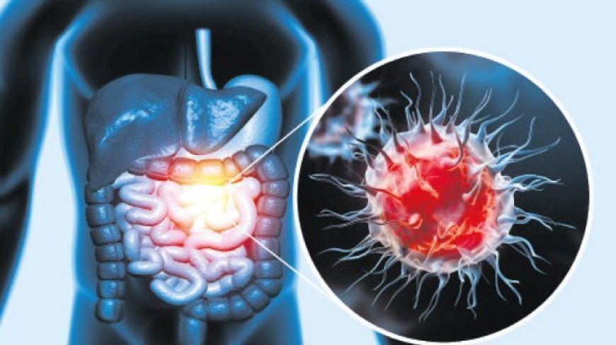 50 yaş altı kolon kanseri alarmı!