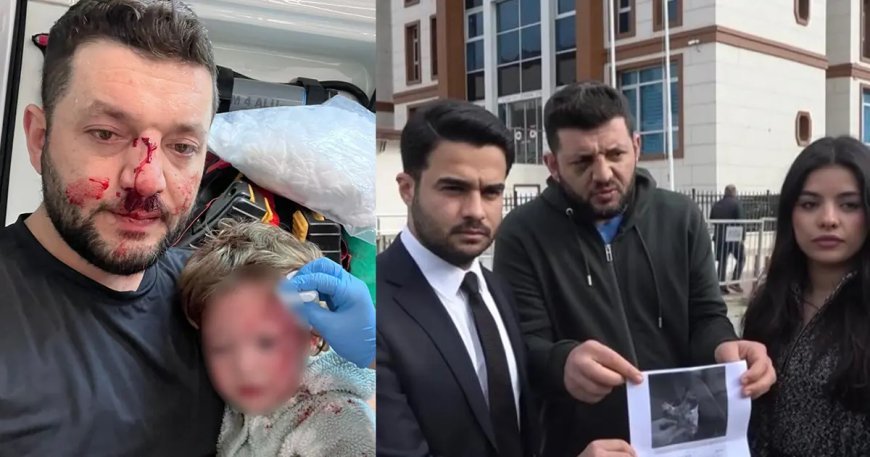 Yalova'da baba ile 14 aylık kızının darbedilmesi. Bebeğe vurduğunu kabul etti!