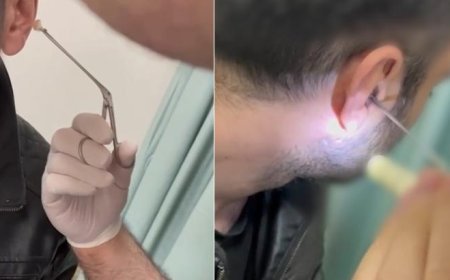 Şüpheli hareketleri dikkat çekmişti! Kulağından çıkanlar şoke etti