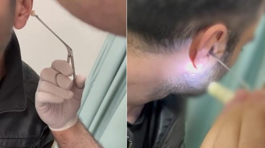 Şüpheli hareketleri dikkat çekmişti! Kulağından çıkanlar şoke etti