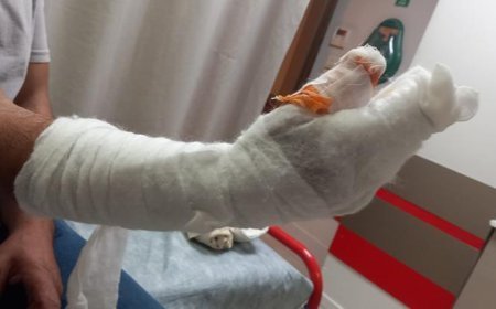 Kocaeli’de skandal iddia: Tedavi sonrası parmağı ampute edildi, kolunda metal bulundu