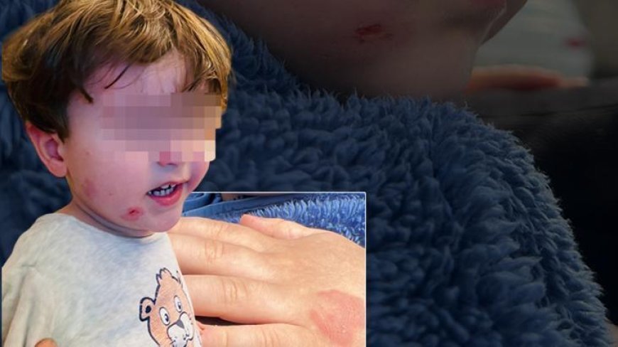 Özel kreşte skandal olay! 2,5 yaşındaki çocuk darp edildi